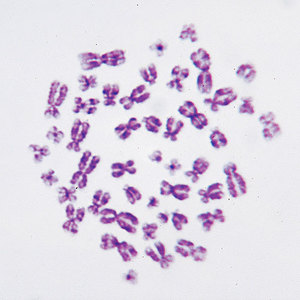 사람염색체(영구프레파라트)